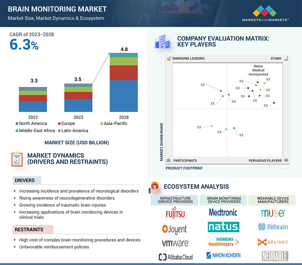 Brain Monitoring Market � Global Forecast and Key Opportunities to 2028
