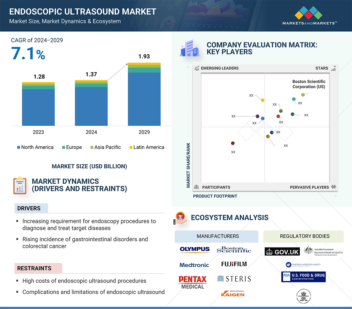 Endoscopic Ultrasonography Market� Global Forecast and Key Opportunities to 2029