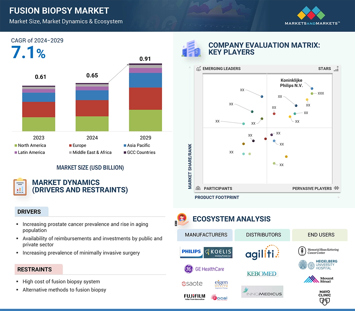 Fusion Biopsy Market � Global Forecast and Key Opportunities to 2029