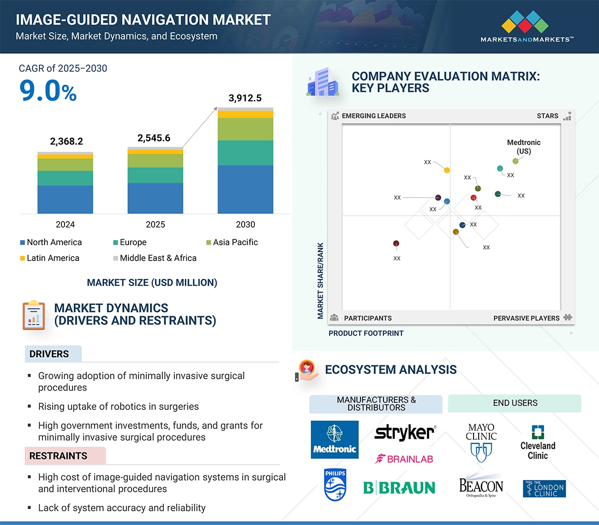 Image-Guided Navigation Market � Global Forecast and Key Opportunities to 2030