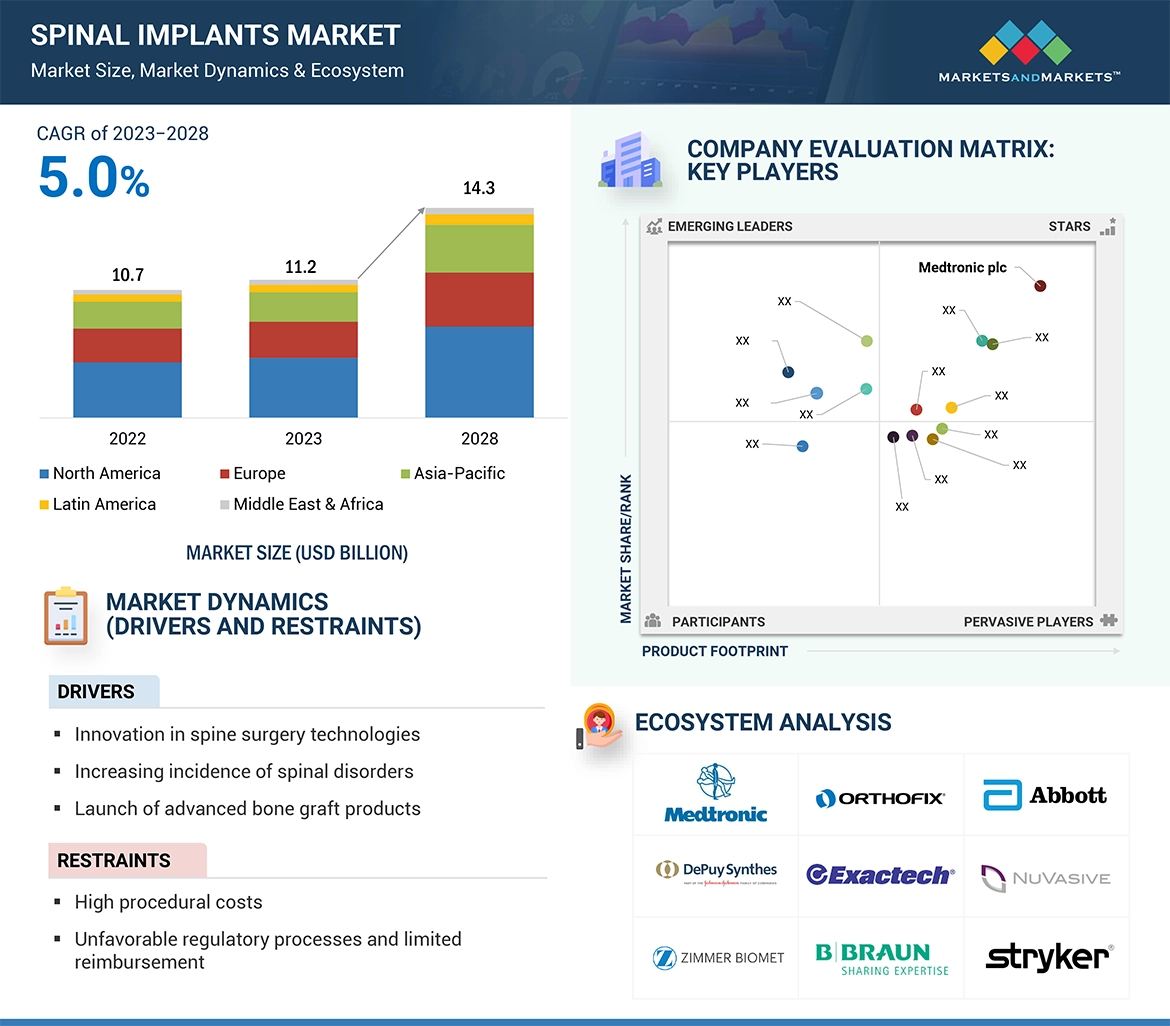 Spinal Implants Market � Global Forecast and Key Opportunities to 2028