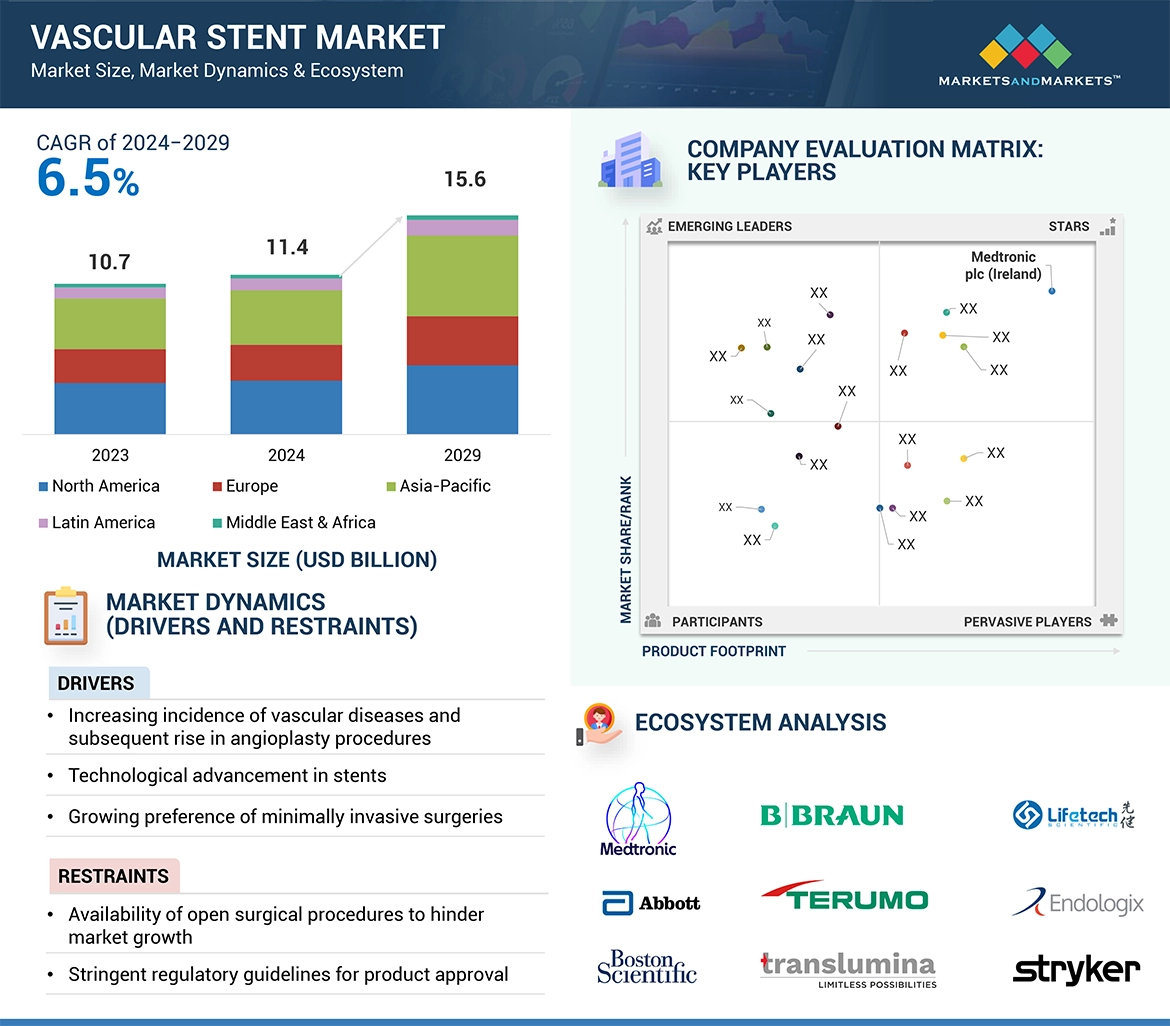 Vascular Stent Market � Global Forecast and Key Opportunities to 2029